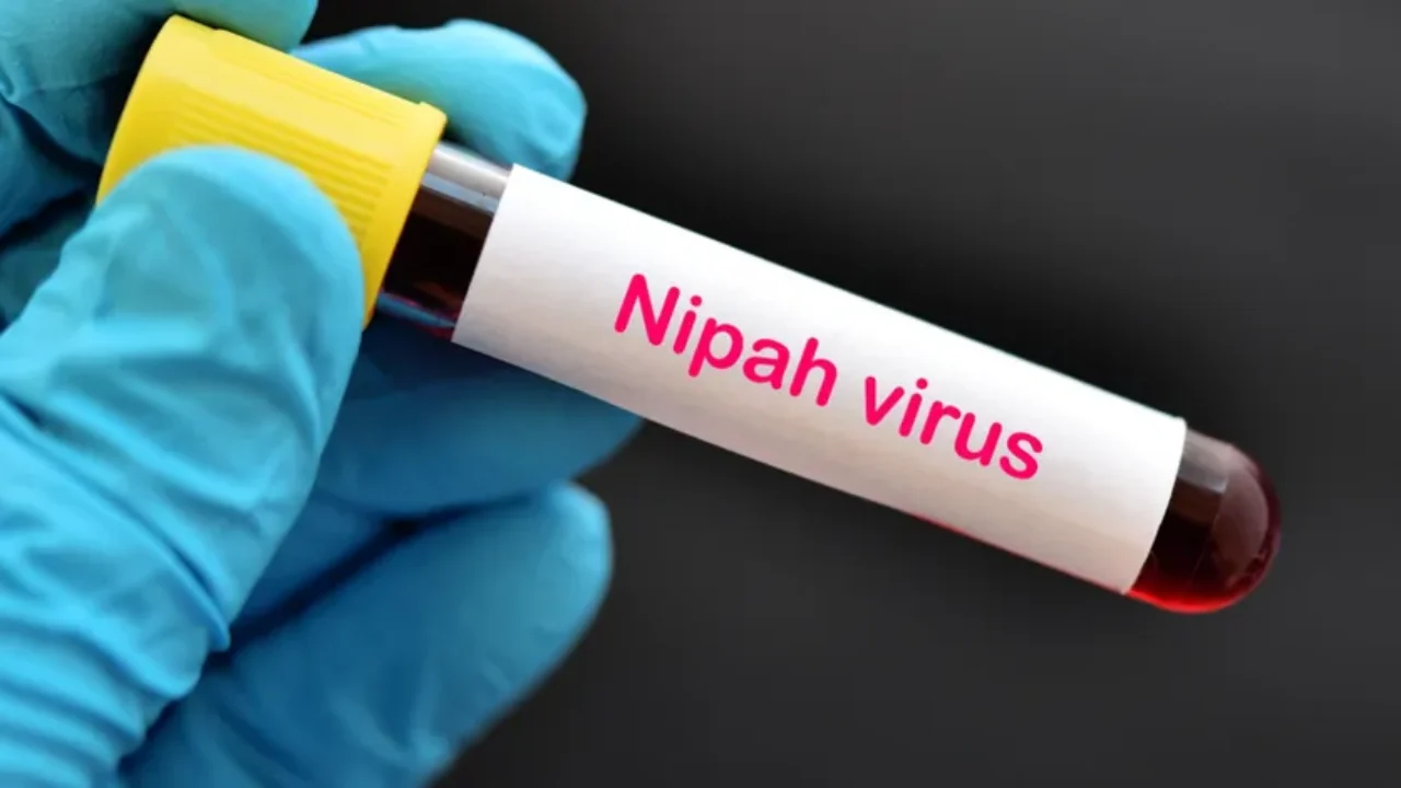 nipah-test